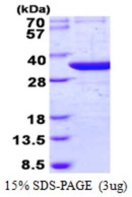 SDS-PAGE: Recombinant Human THG1L His Protein [NBP2-22890]