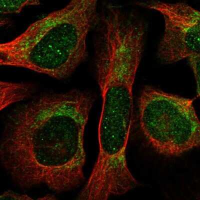 Immunocytochemistry/ Immunofluorescence: THNSL1 Antibody [NBP1-82130]