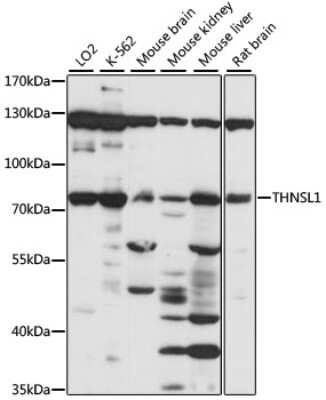 Western Blot: THNSL1 AntibodyAzide and BSA Free [NBP2-93147]