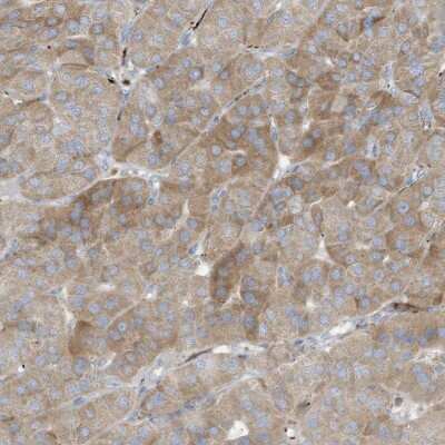 Immunohistochemistry-Paraffin: THNSL2 Antibody [NBP1-83811]