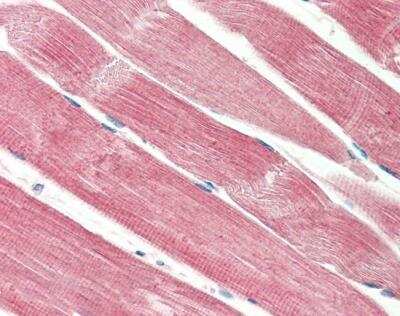 Immunohistochemistry-Paraffin: THNSL2 Antibody [NBP2-26093]