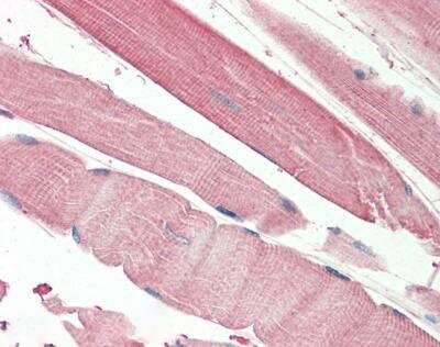 Immunohistochemistry-Paraffin: THNSL2 Antibody [NBP2-26173]