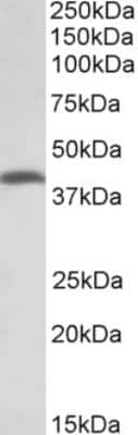 Western Blot: THNSL2 Antibody [NBP2-26173]