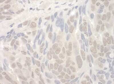 Immunohistochemistry: THOC2 Antibody [NBP2-04055]