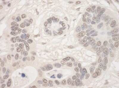 Immunohistochemistry: THOC2 Antibody [NBP2-04056]