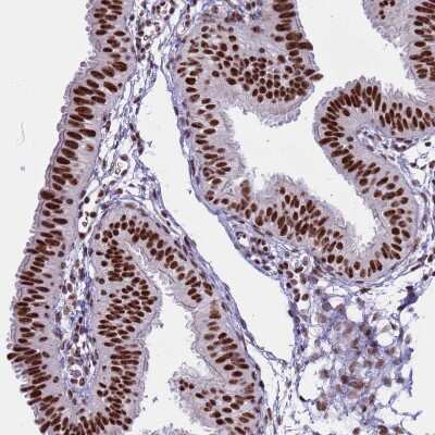 Immunohistochemistry-Paraffin: THOC2 Antibody [NBP1-92500]