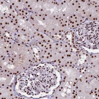 Immunohistochemistry-Paraffin: THOC2 Antibody [NBP1-92500]