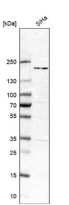 Western Blot: THOC2 Antibody [NBP1-92500]