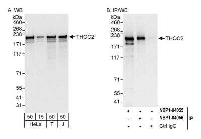 Western Blot: THOC2 Antibody [NBP2-04055]