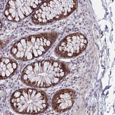 Immunohistochemistry-Paraffin: THOC3 Antibody [NBP1-92502]