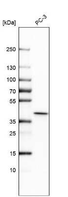 Western Blot: THOC3 Antibody [NBP1-92502]
