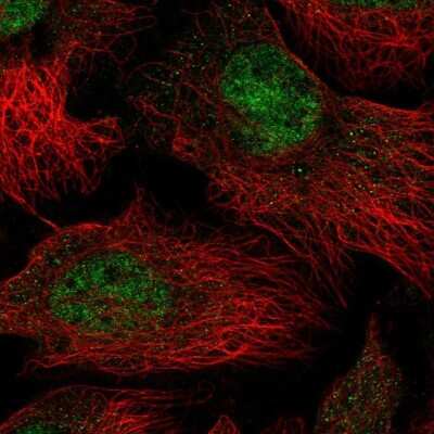 Immunocytochemistry/ Immunofluorescence: THOC5 Antibody [NBP2-57331]