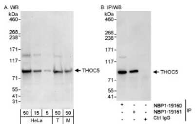 Western Blot: THOC5 Antibody [NBP1-19160]