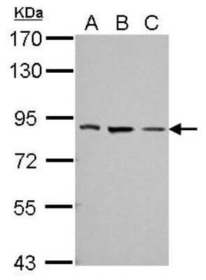 Western Blot: THOC5 Antibody [NBP2-20621]