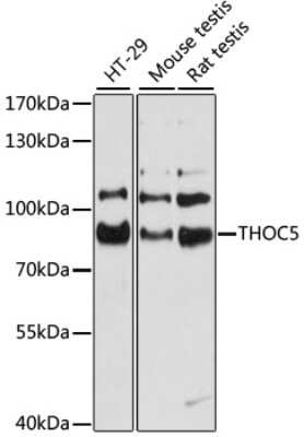 Western Blot: THOC5 AntibodyAzide and BSA Free [NBP2-93594]