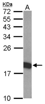 Western Blot: THOC7 Antibody [NBP2-20622]