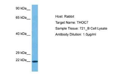 Western Blot: THOC7 Antibody [NBP2-85910]