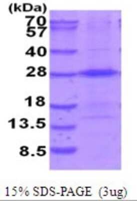 SDS-PAGE: Recombinant Human THOC7 His Protein [NBP2-51950]