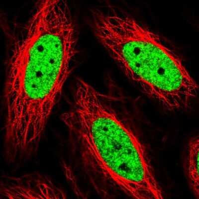 Immunocytochemistry/ Immunofluorescence: THRAP3 Antibody [NBP2-57174]