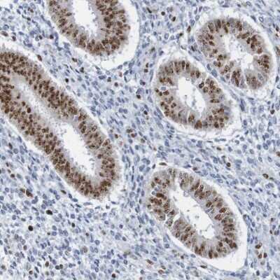Immunohistochemistry-Paraffin: THRAP3 Antibody [NBP1-86915]