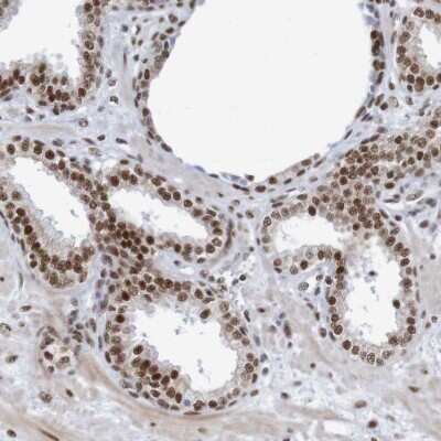 Immunohistochemistry-Paraffin: THRAP3 Antibody [NBP1-86915]
