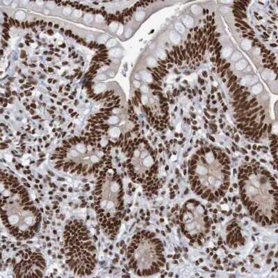 Immunohistochemistry-Paraffin: THRAP3 Antibody [NBP1-86915]