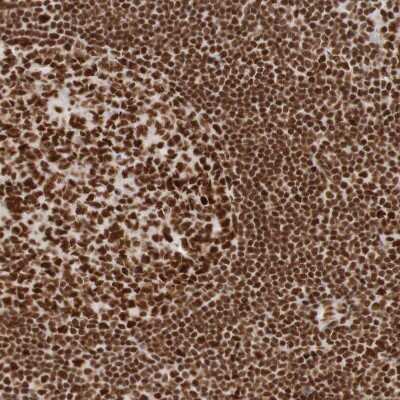 Immunohistochemistry-Paraffin: THRAP3 Antibody [NBP1-86915]
