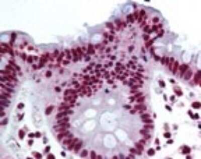 Immunohistochemistry-Paraffin: THRAP3 Antibody [NBP2-24477]