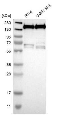 Western Blot: THRAP3 Antibody [NBP1-86915]