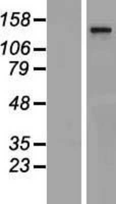 Western Blot: THRAP3 Overexpression Lysate [NBP2-07790]