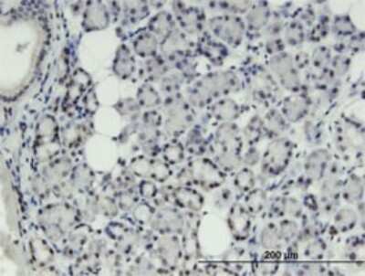 Immunohistochemistry-Paraffin: THRSP Antibody (2F8) [H00007069-M01]