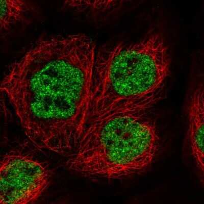 Immunocytochemistry/ Immunofluorescence: THRSP Antibody [NBP1-81290]