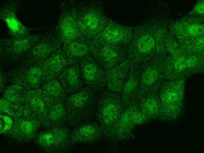 Immunocytochemistry/ Immunofluorescence: THRSP Antibody [NBP2-98508]