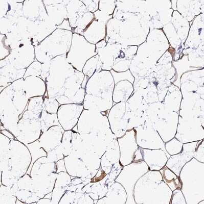 Immunohistochemistry-Paraffin: THRSP Antibody [NBP1-81290]
