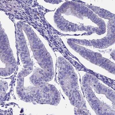 Immunohistochemistry-Paraffin: THRSP Antibody [NBP1-81290]