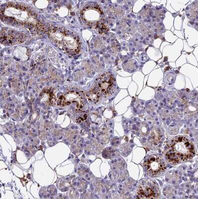 Immunohistochemistry-Paraffin: THRSP Antibody [NBP1-81290]