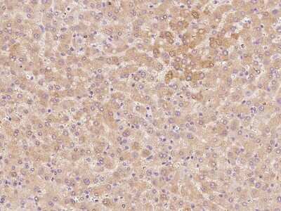 Immunohistochemistry-Paraffin: THRSP Antibody [NBP2-98508]