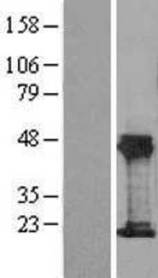 Western Blot: THRSP Overexpression Lysate [NBL1-16897]