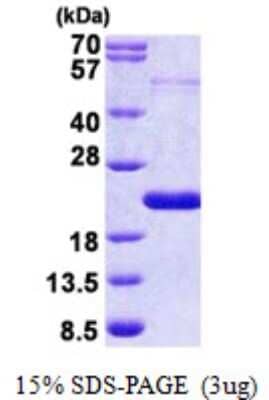 SDS-PAGE: Recombinant Human THRSP His Protein [NBP2-22865]