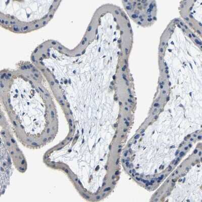Immunohistochemistry-Paraffin: THSD1 Antibody [NBP1-86930]