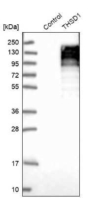 Western Blot: THSD1 Antibody [NBP1-86930]