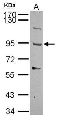 Western Blot: THSD1 Antibody [NBP2-20624]