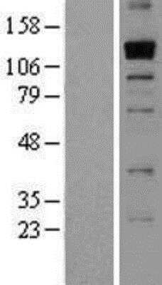 Western Blot: THSD1 Overexpression Lysate [NBP2-06785]