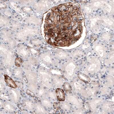 Immunohistochemistry-Paraffin: THSD7A Antibody (CL3778) [NBP2-61638]