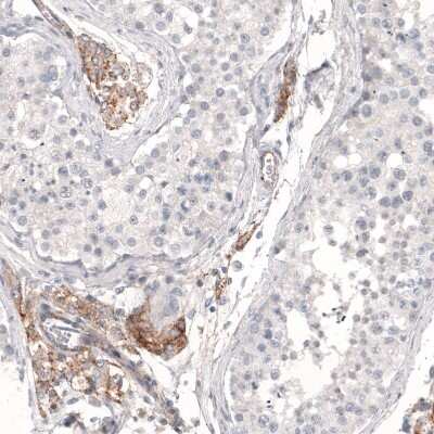 Immunohistochemistry-Paraffin: THSD7A Antibody (CL3778) [NBP2-61638]