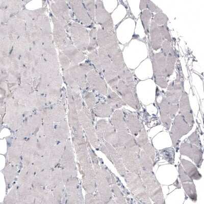 Immunohistochemistry-Paraffin: THSD7A Antibody (CL3778) [NBP2-61638]