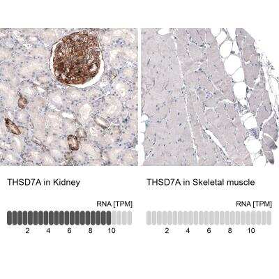 Immunohistochemistry-Paraffin: THSD7A Antibody (CL3778) [NBP2-61638]