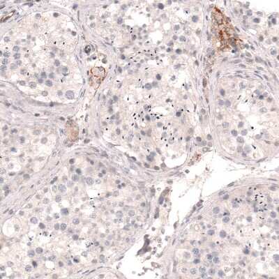 Immunohistochemistry-Paraffin: THSD7A Antibody (CL3779) [NBP2-61639]