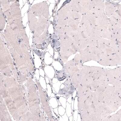 Immunohistochemistry-Paraffin: THSD7A Antibody (CL3779) [NBP2-61639]