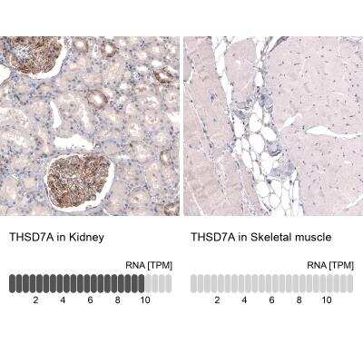 Immunohistochemistry-Paraffin: THSD7A Antibody (CL3779) [NBP2-61639]